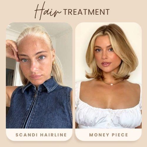 Scandi Hairline vs Money Piece
