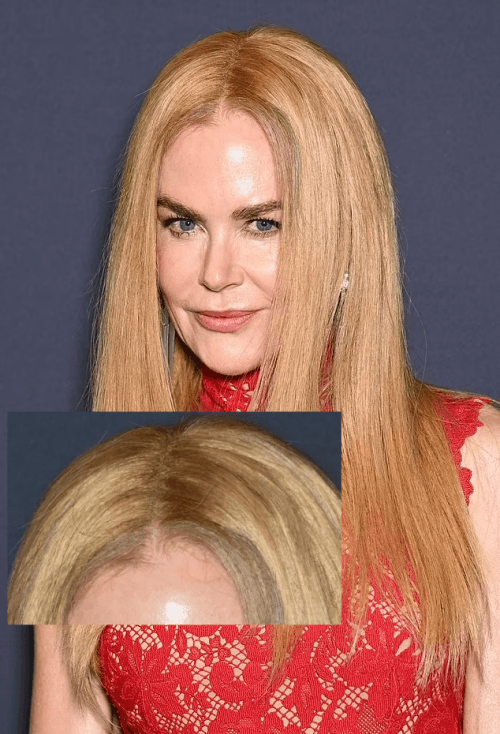 nicole kidman wig
